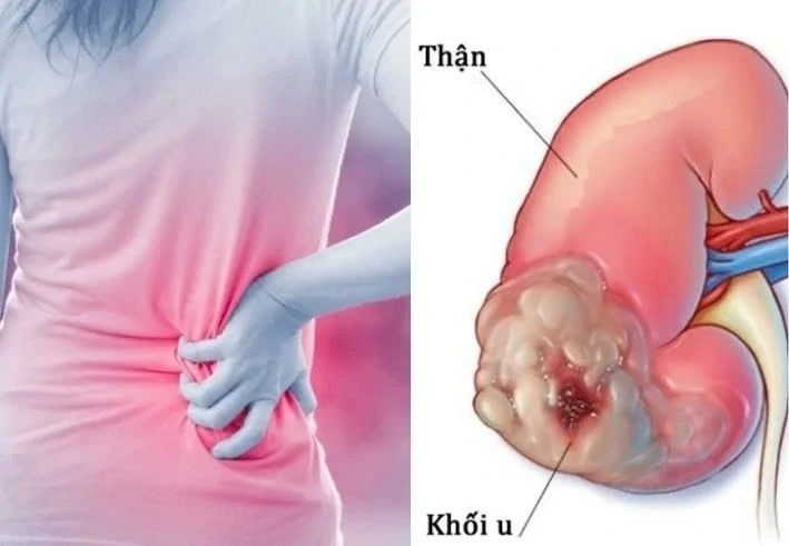 Giảm cân bất thường và chán ăn
